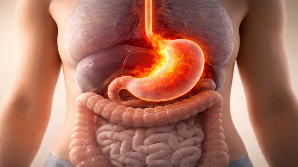 एसिडिटी की पहचान कैसे करें? | Acidity Ki Pehchan Kaise Karein? 4 acidity