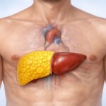 ktna dangerous hai fatty liver